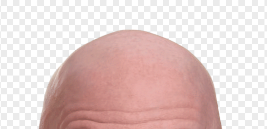 bald