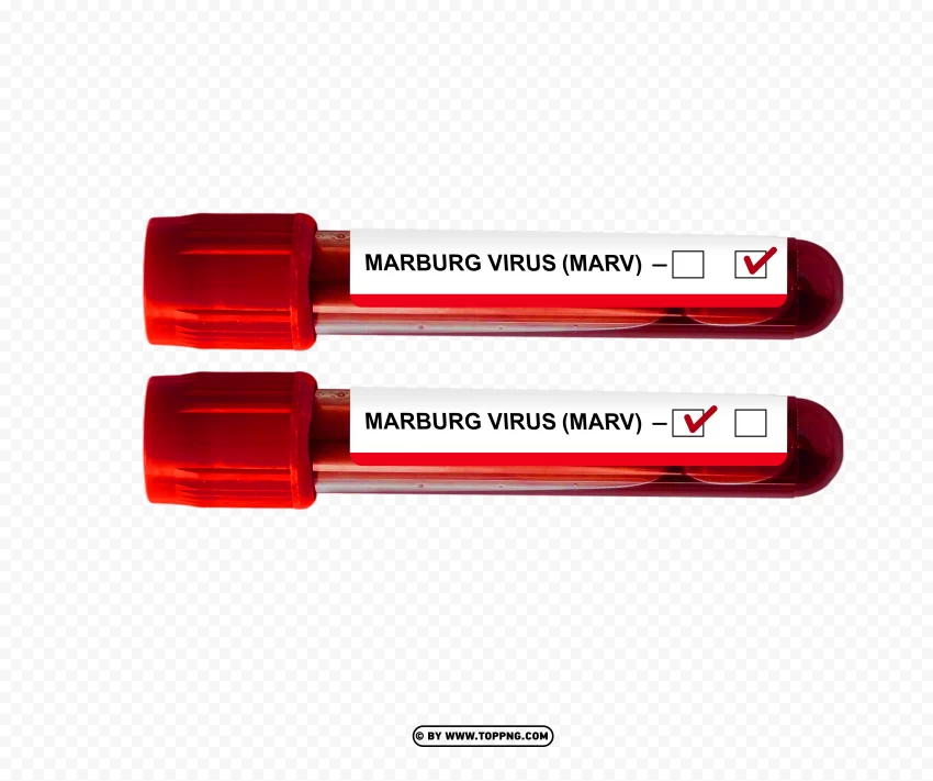 Marburg Virus Positive And Negative Blood Samples In Test Tube PNG Transparent Background