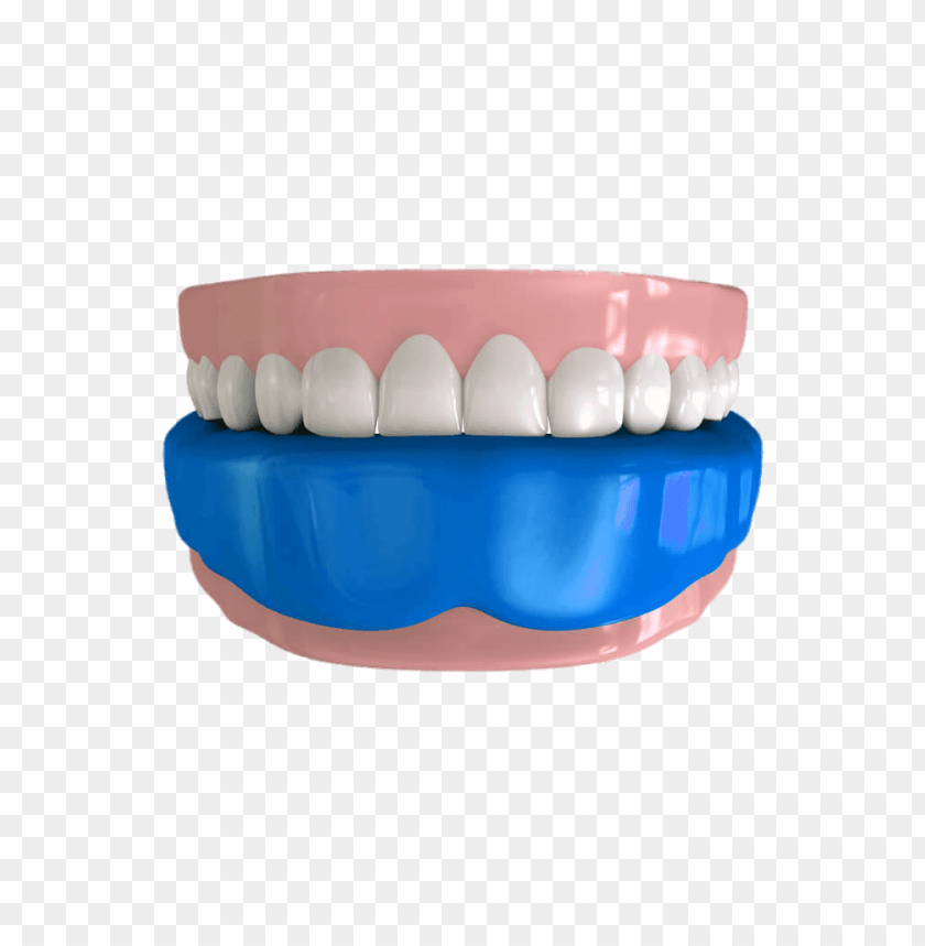 sports, mouthguards, mouthguard on lower teeth illustration, 