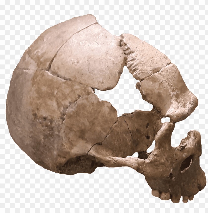 
skull
, 
human skull
, 
skeleton skull
, 
brain holder
