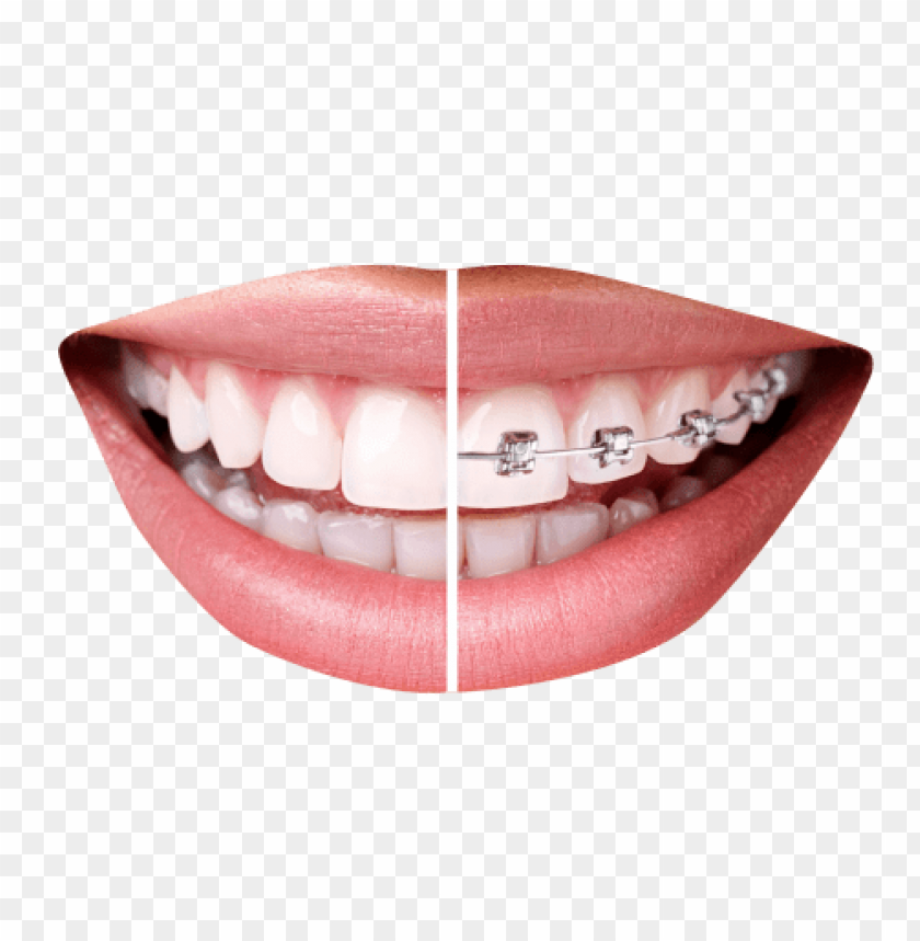 tooth png, tooth,png